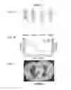 Fig. 02 - Method of Treating Cancer