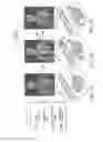 Fig. 02 - REFILLABLE DRUG DELIVERY DEVICES AND METHODS OF USE THEREOF