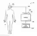 Fig. 01 - Fluid depletion warning system for phacoemulsification surgical applications