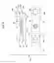 Fig. 07 - Accurate volume fluid collection card system