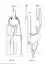 Fig. 07 - Discharge electrode suspension system using rings