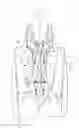 Fig. 02 - Ply architecture for integral platform and damper retaining features in CMC turbine blades