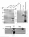 Fig. 06 - DEVICE AND METHODS FOR THE IMMUNOLOGICAL IDENTIFICATION OF CEREBROSPINAL FLUID