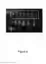 Fig. 07 - DEVICE AND METHODS FOR THE IMMUNOLOGICAL IDENTIFICATION OF CEREBROSPINAL FLUID