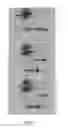 Fig. 08 - DEVICE AND METHODS FOR THE IMMUNOLOGICAL IDENTIFICATION OF CEREBROSPINAL FLUID