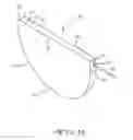 Fig. 10 - High voltage tantalum anode and method of manufacture