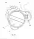 Fig. 22 - Hands-free Pot Scrubber