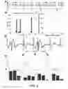 Fig. 03 - Assessment of hemodynamic function in arrhythmia patients