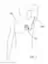 Fig. 02 - Patient worn sensor assembly