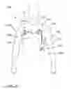 Fig. 09 - Patient worn sensor assembly