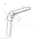 Fig. 01 - Illuminated surgical retractor