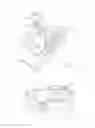 Fig. 02 - Orthopedic plating assembly for bone fixation and subsidence