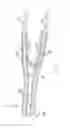 Fig. 05 - Septotomy catheter for aortic dissection