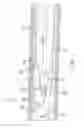 Fig. 09 - Septotomy catheter for aortic dissection