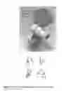 Fig. 07 - ACTIVE ORTHOSIS FOR SURGEONS