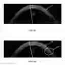 Fig. 05 - Closed-loop laser eye surgery treatment