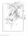 Fig. 14 - Adjustable surgical support system