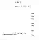Fig. 02 - Therapeutic agent for disease based on inhibitory effect of macrophage migration inhibitory factor