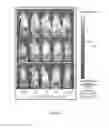Fig. 07 - Mixed micelles