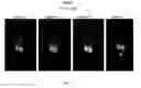 Fig. 07 - LABELED INHIBITORS OF PROSTATE SPECIFIC MEMBRANE ANTIGEN (PSMA), THEIR USE AS IMAGING AGENTS AND PHARMACEUTICAL AGENTS FOR THE TREATMENT OF PROSTATE CANCER