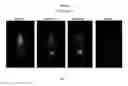 Fig. 08 - LABELED INHIBITORS OF PROSTATE SPECIFIC MEMBRANE ANTIGEN (PSMA), THEIR USE AS IMAGING AGENTS AND PHARMACEUTICAL AGENTS FOR THE TREATMENT OF PROSTATE CANCER