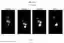 Fig. 09 - LABELED INHIBITORS OF PROSTATE SPECIFIC MEMBRANE ANTIGEN (PSMA), THEIR USE AS IMAGING AGENTS AND PHARMACEUTICAL AGENTS FOR THE TREATMENT OF PROSTATE CANCER