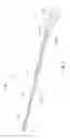 Fig. 12 - SHORT WIRE CABLE CATHETER