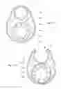 Fig. 15 - SHORT WIRE CABLE CATHETER
