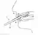 Fig. 01 - Oral cavity function training tool