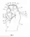 Fig. 06 - Pen/Pencil Grip