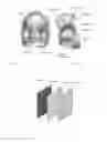 Fig. 02 - Adjustable pressure suit torso