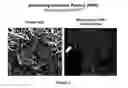 Fig. 04 - Composition and methods for the treatment of CaMKK2-mediated disorders