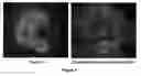 Fig. 05 - Composition and methods for the treatment of CaMKK2-mediated disorders