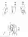 Fig. 06 - Apparatus and method for non-occluded active noise shaping