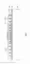 Fig. 04 - Method for forming a passive device on a package-on-package structure