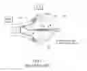 Fig. 02 - BALLOON CATHETER ABLATION SYSTEM
