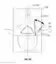 Fig. 07 - System and method for medical device placement in bone
