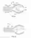 Fig. 08 - Preventing instrument/tissue collisions