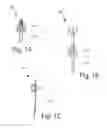 Fig. 02 - INTRAVAGINAL DEVICE WITHDRAWAL ASSEMBLY