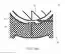 Fig. 16 - Insert with nozzle formed by micro stepped and conical surfaces