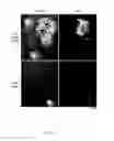 Fig. 03 - Method, kits and materials for detection of Lyme disease sp. infection