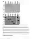 Fig. 17 - Method, kits and materials for detection of Lyme disease sp. infection