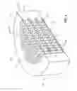 Fig. 07 - Deposited material sand control media