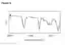 Fig. 07 - Spectroscopy for gunshot residue analysis