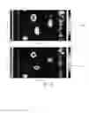 Fig. 18 - Medium-range magnetostrictive ultrasonic guided wave scanner systems and methods