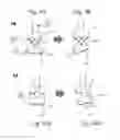 Fig. 08 - Deployment mechanism for passive normalization of a probe relative to a surface