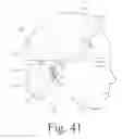 Fig. 42 - Wearable and mobile brain computer interface (BCI) device and method