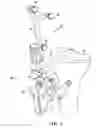 Fig. 06 - Method and system for managing inventories of orthopaedic implants