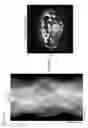 Fig. 02 - Computed tomography scanner calibration with angle correction for scan angle offset