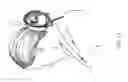 Fig. 12 - Hairstyle enhancing accessory